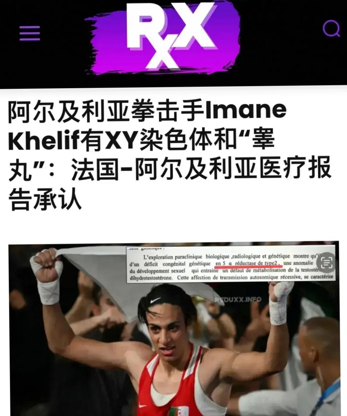 马耳他拳击手力克对手，摘得金牌